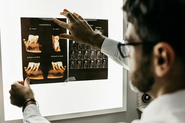 Digital X-ray review